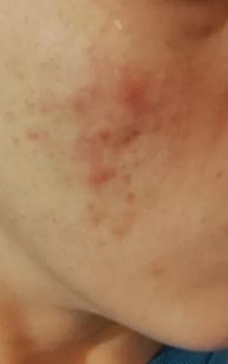 Tag 1