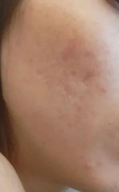 Tag 7